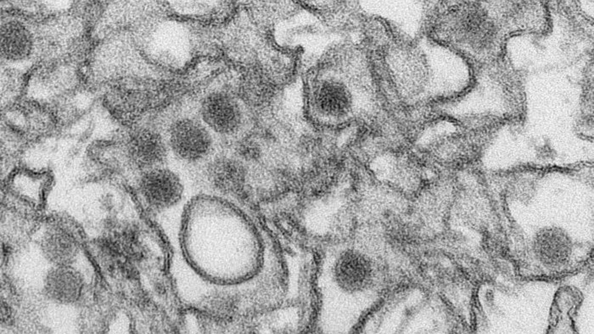 A transmission electron micrograph of Zika virus. Virus particles are 40 nm in diameter with an outer envelope and an inner dense core.