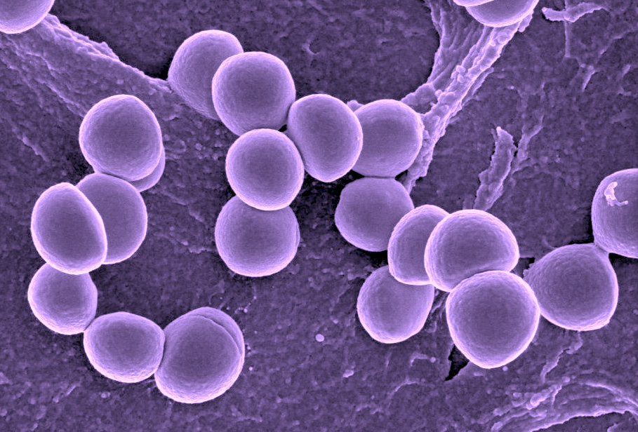 Staphylococcus aureus is a versatile bacterium that is commonly found on the skin or noses of people and animals.