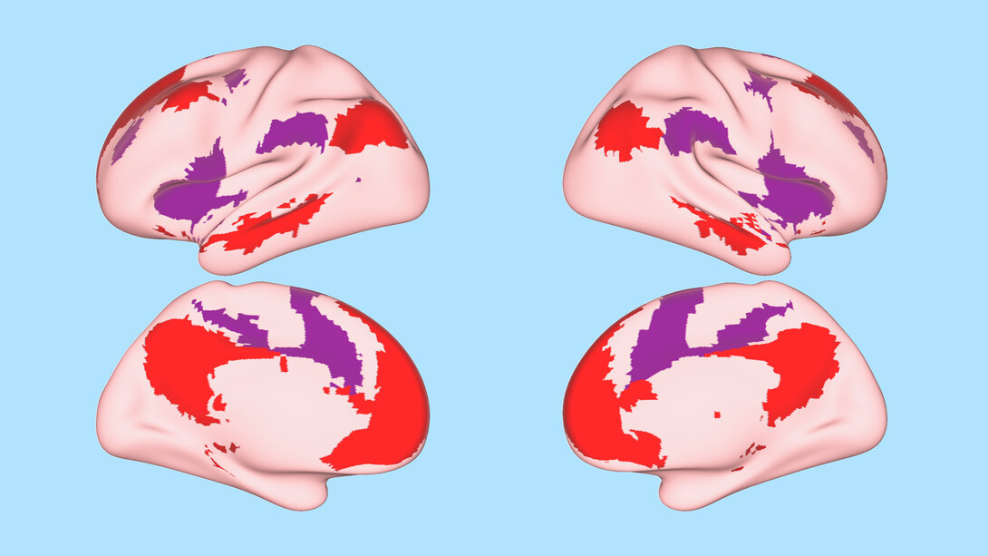 An illustration shows a map of relevant brain networks superimposed on the right hemisphere of the human brain.